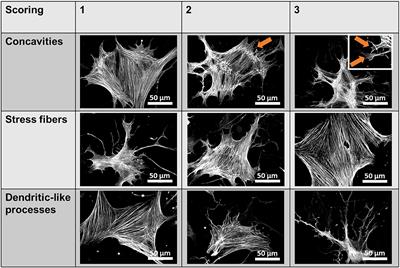 Protonation of Piezo1 Impairs Cell-Matrix Interactions of Pancreatic Stellate Cells